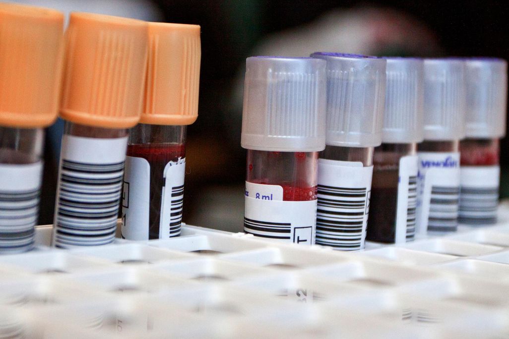 blood in test tube