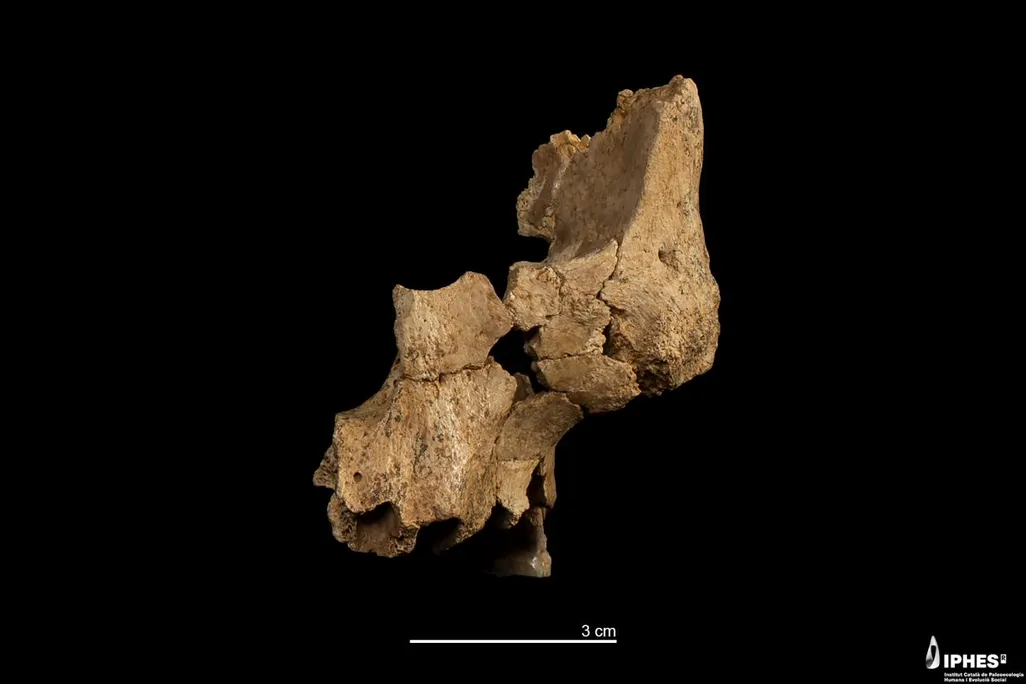 Fragments of a facial bone against a black background