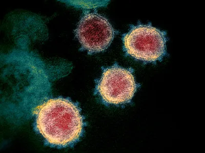 &nbsp;Researchers speculate that type two inflammation that occurs in allergic conditions may reduce levels of the ACE2 receptor on the surface of airway cells, where SARS-CoV-2&rsquo;s spike protein binds to. (Pictured: Novel Coronavirus SARS-CoV-2 under and electron microscope)