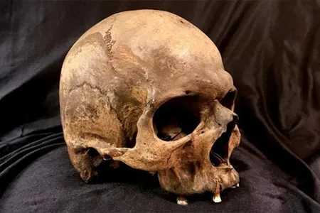 A Late Neolithic skull. For the recent study, scientists extracted DNA from skulls and teeth to look for traces of diseases.