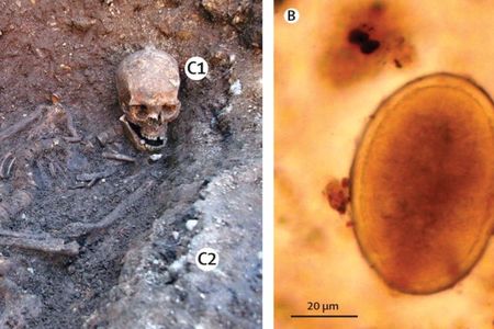 A sacral sample (S) taken from Richard III revealed ancient roundworm eggs. Control samples from his skull (C1) and outside of the grave (C2) linked the infection to his body.
