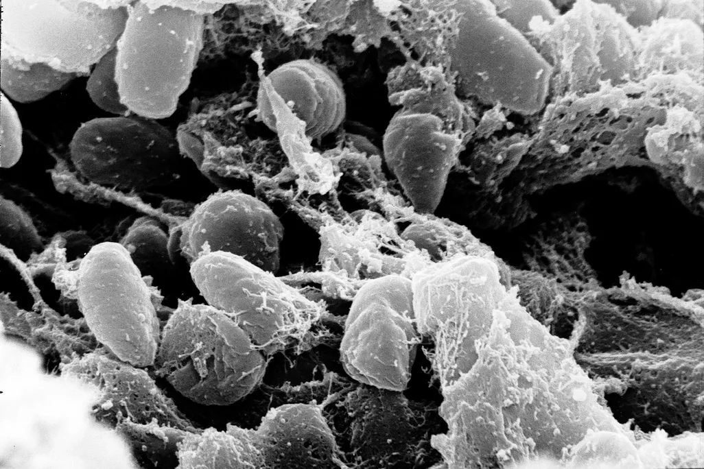 An image captured by a scanning electron microscope of Yersinia pestis bacteria, which causes the bubonic plague.