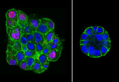 Fluorescence images of uncompressed (left) and compressed (right) colonies of malignant breast epithelial cells. Compressed colonies are smaller and more organized.