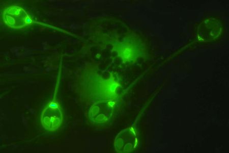 Henneguya salminicola, a parasite that doesn't need to breathe oxygen to survive