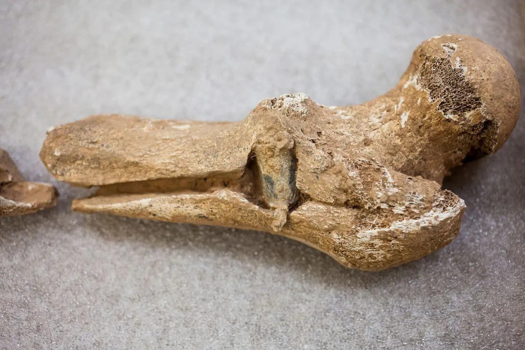 Newly Unearthed Civil War Bones Speak Silently to the Grim Aftermath of Battle