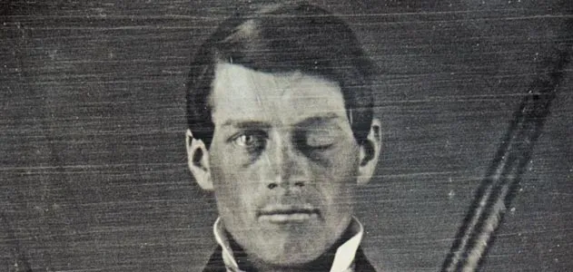 Why Scientists Are Still Fascinated By Phineas Gage