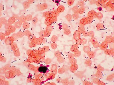 This photomicrograph reveals shows a type of Enterococcus bacteria. Strains of Enterococcus are commonly found in the gut.
