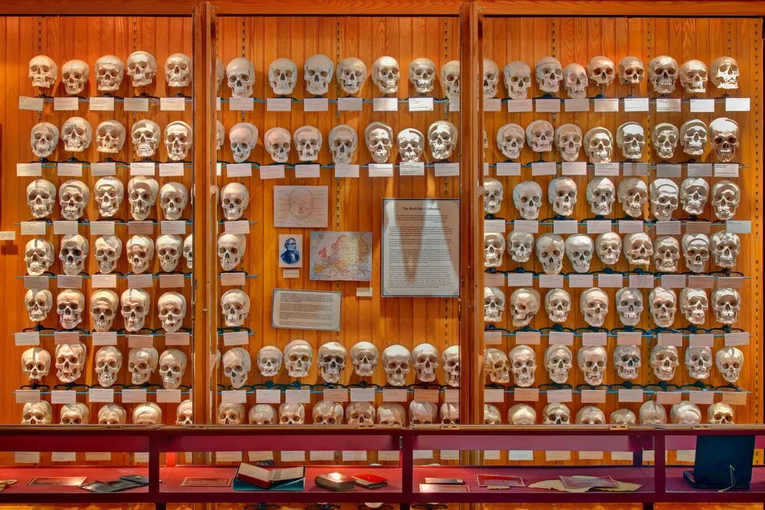 The Hyrtl Skull Collection