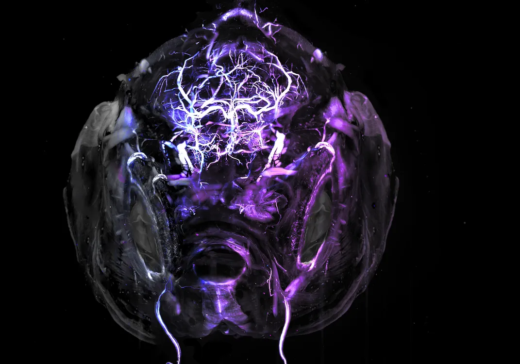 a brain structure seen from slightly above, with purple tendrils throughout the center