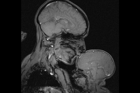 Scientists reconfigured a magnetic resonance scanner to capture a woman and her baby.
