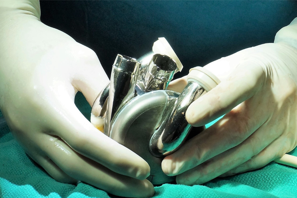 gloved hands holding a metal device