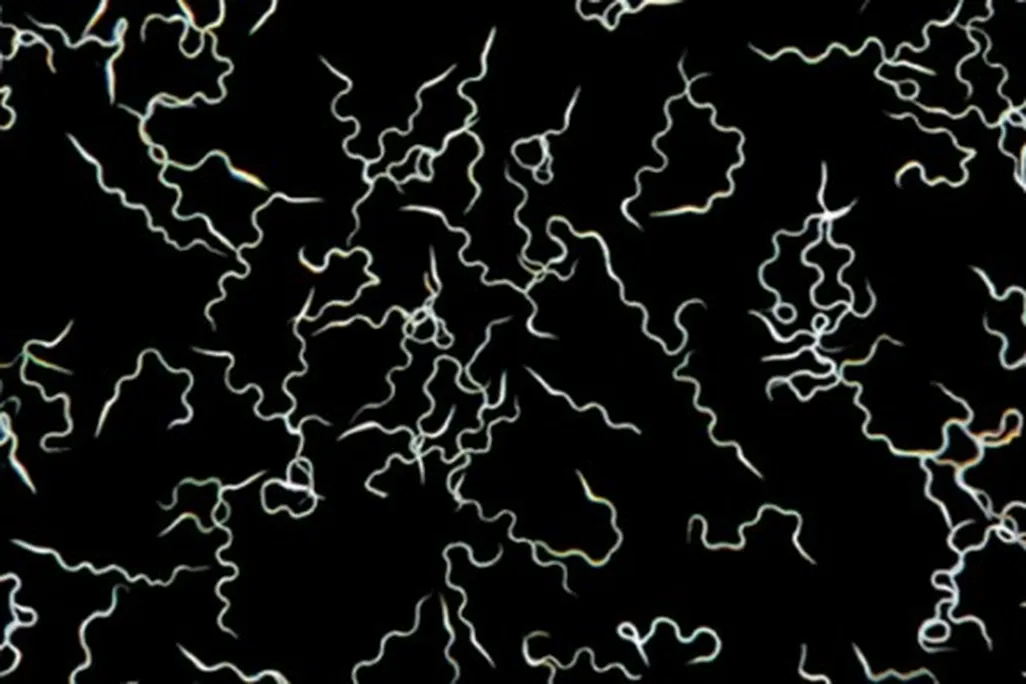 sperm.jpg