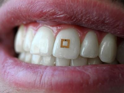 Tooth-mounted sensor