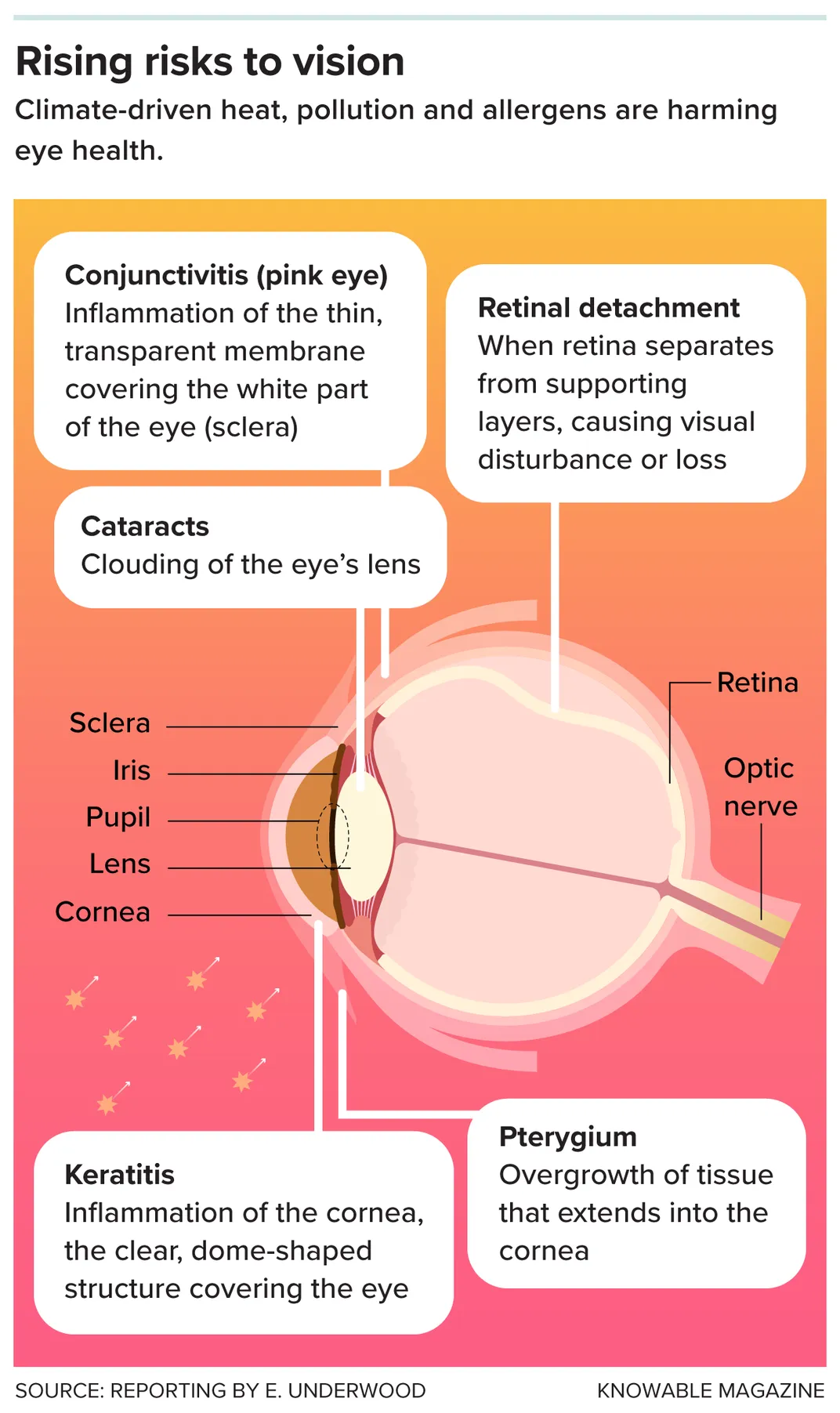 Risks to Vision Graphic