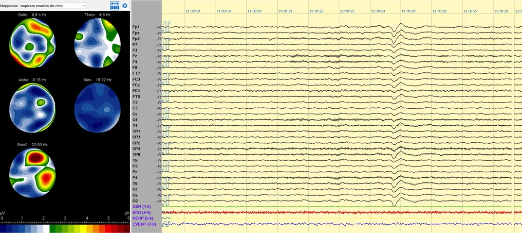 activity of different kinds of brain waves shown in scans at the left, and a readout of brain activity in lines on the right