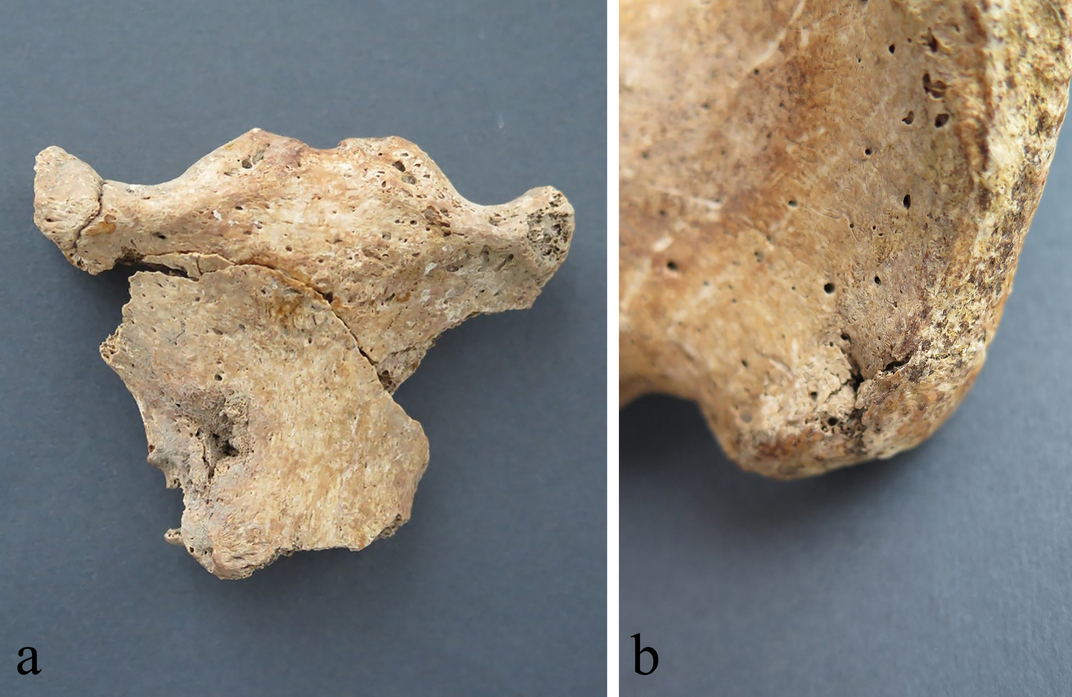 puncture wounds in bones