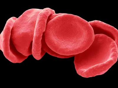Modern microscopes can image red blood cells in stunning detail.