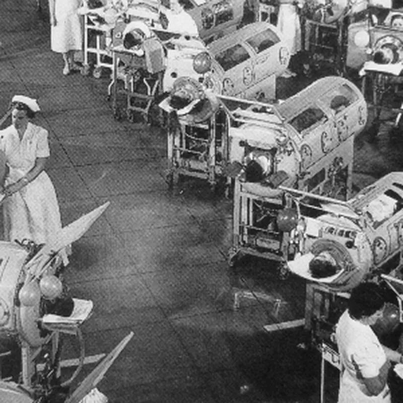Polio 1950s Polio Virus: 23 Photos Of 1950s Outbreak Business