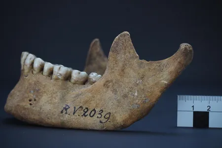 Ancient DNA and proteins gathered from the specimen's bones and teeth revealed the presence of Yersinia pestis. 