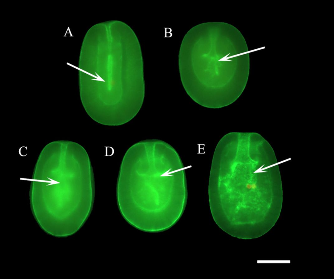 Coral Larvae 2