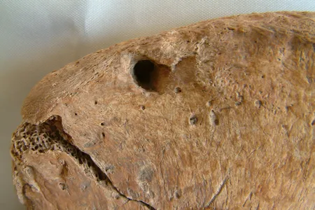 Researchers analyzed indentations in the skeleton's pelvis.