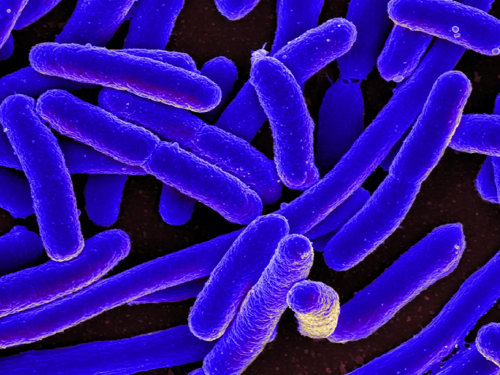 An image of E. coli