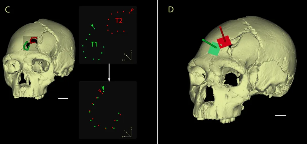 Researchers used a 3D model to analyze the skull's two fractures in detail. Photo: Sala et al., PLOS ONE
