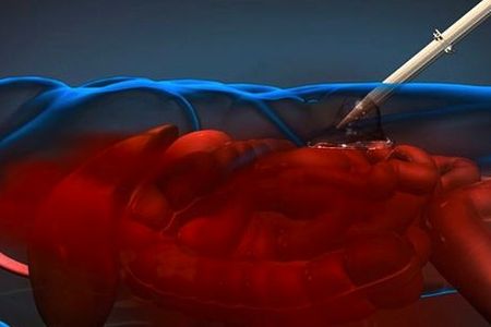 An illustration of the potential new treatment.