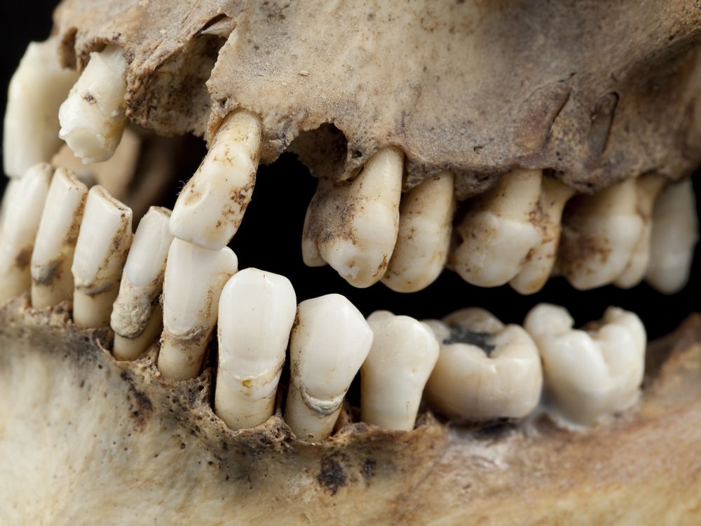 Ancient teeth