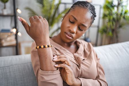 Eczema affects almost 32 million people in the United States.