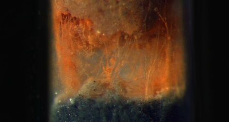 Microscopic bacteria