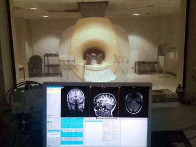 Scientists used this MRI scanner to compare the brains of blind and sighted people. 