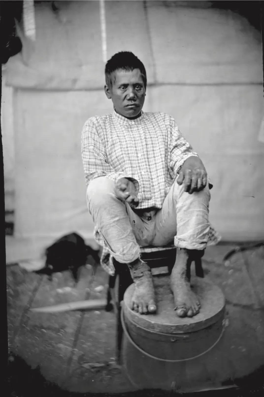 An 1878 photo of Kaapu, a leprosy patient who later died on Kalaupapa