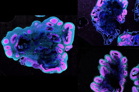 After five weeks of development, a human brain organoid (left) is roughly twice the size of those from a chimpanzee  (top right) and a gorilla (bottom right).

