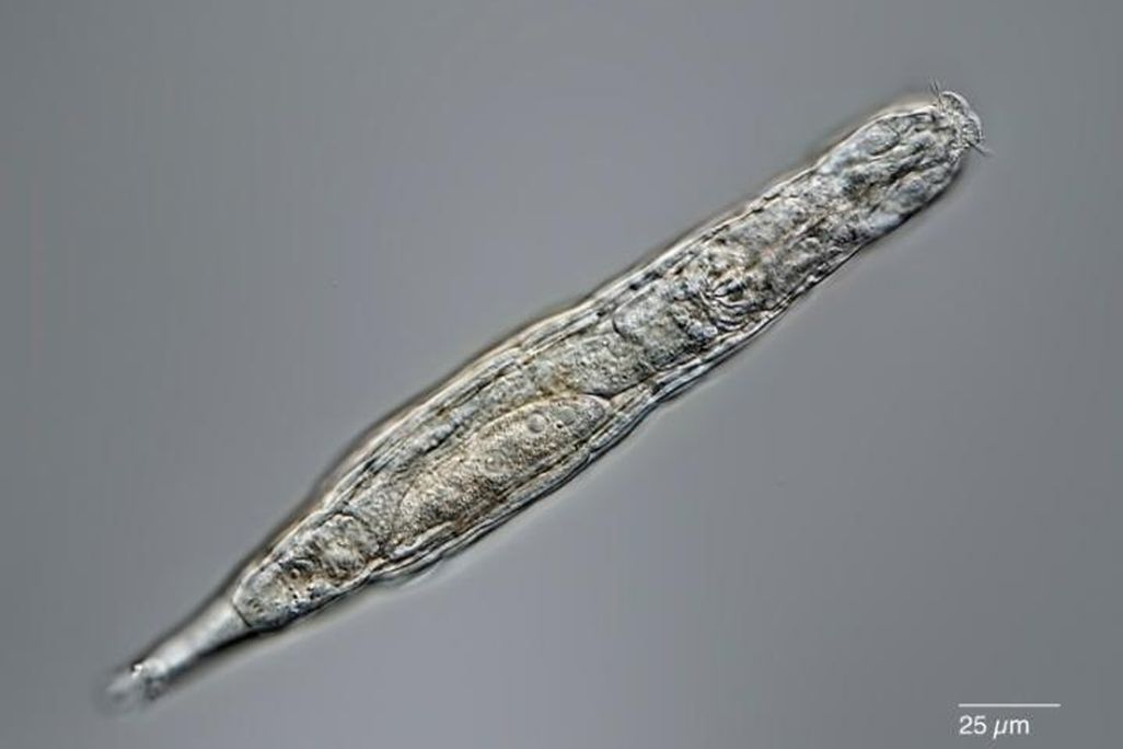 A rotifer seen under a microscope