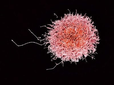 Immune system natural killer cell