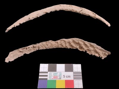 From these upper hip bones, researchers extracted an ancient genome of the bacteria that causes syphilis.