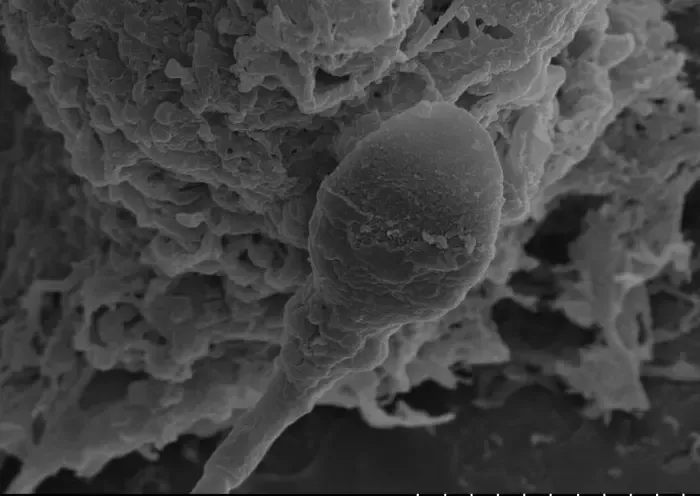 a close up of what looks like a sperm cell
