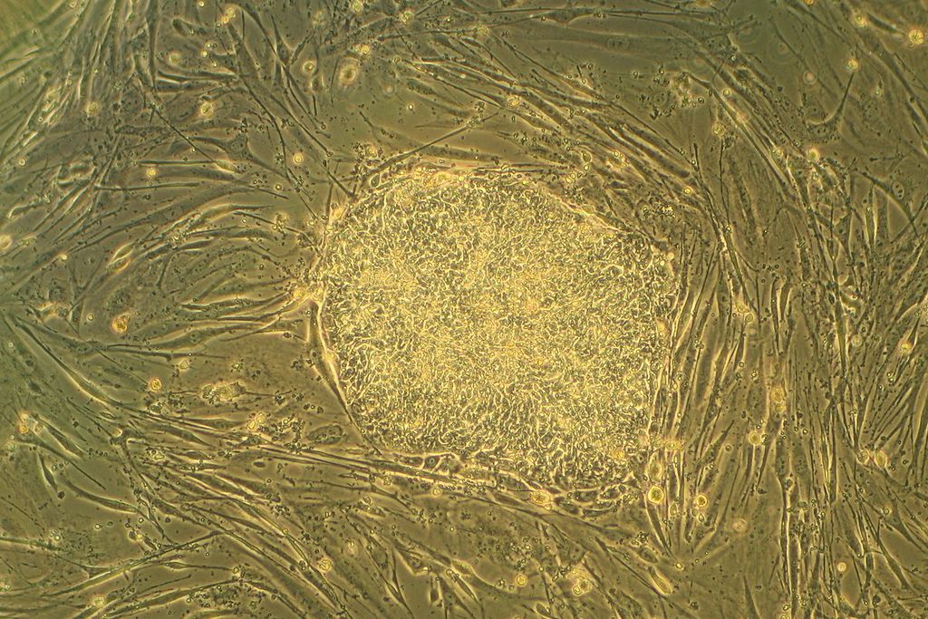 Human embryonic stem cells in cell culture