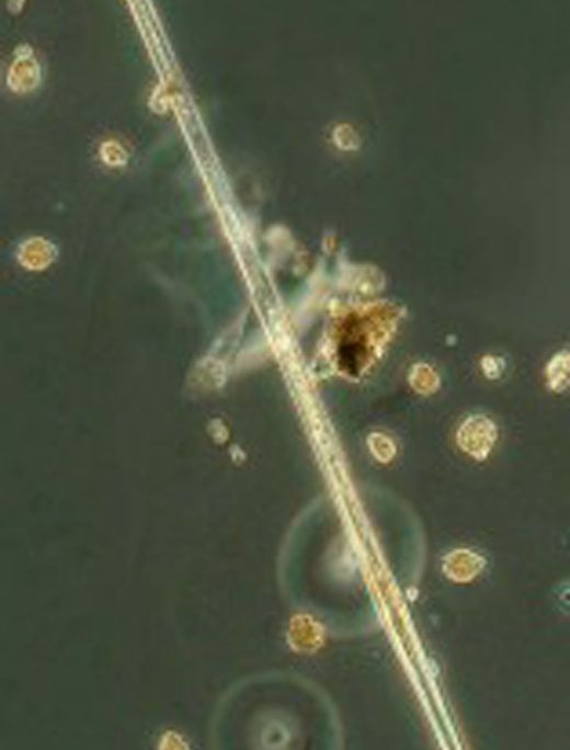 Amphisolenia-hires-11-157x300.jpg