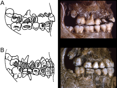 Teeth from humans who belonged to the Pavlovian culture show unexpected signs of wear.