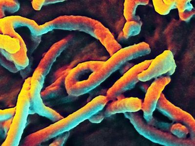 A digitally-colorized scanning electron micrograph (SEM) of Ebola virus particles.