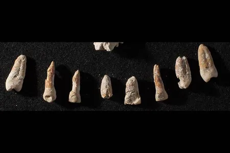 Teeth with dental inlays from a nonroyal elite Mayan tomb.