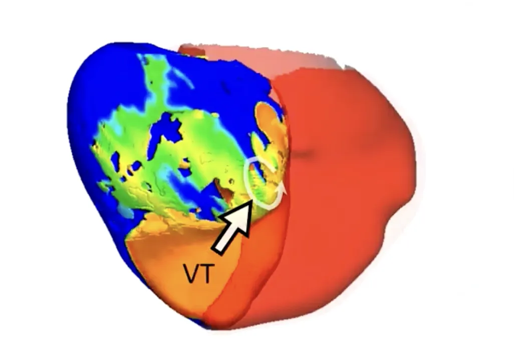 a digital heart