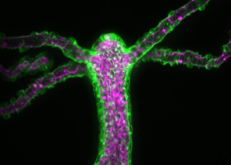 Transgenic Hydra