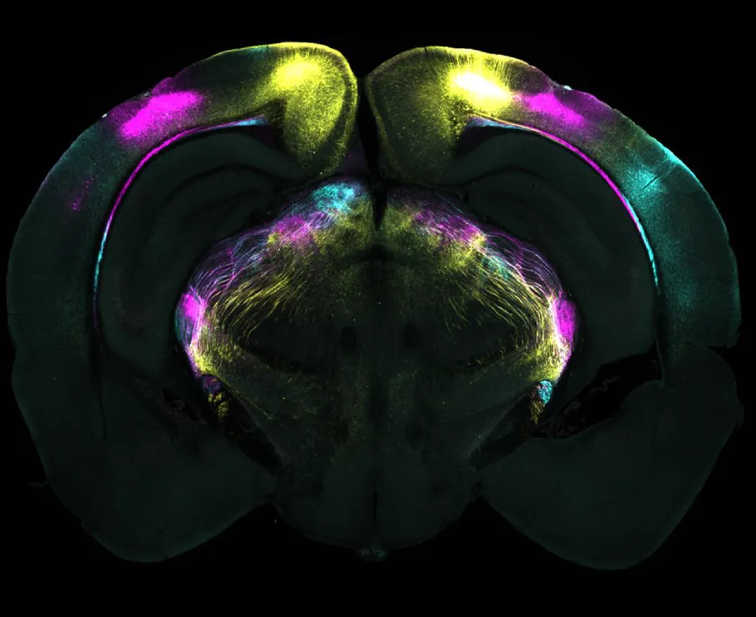 A brain slice with colored projections