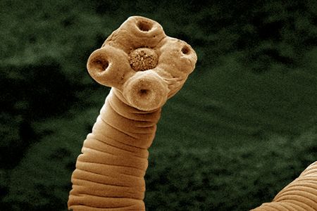 Tapeworms, like this one imaged using a scanning electron micrograph, weaken their victims but don't typically kill them. 