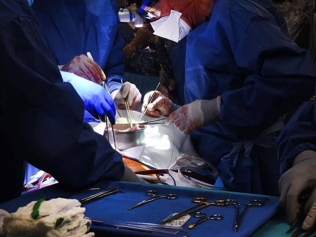 Surgeons Transplant a Pig Heart Into a Human