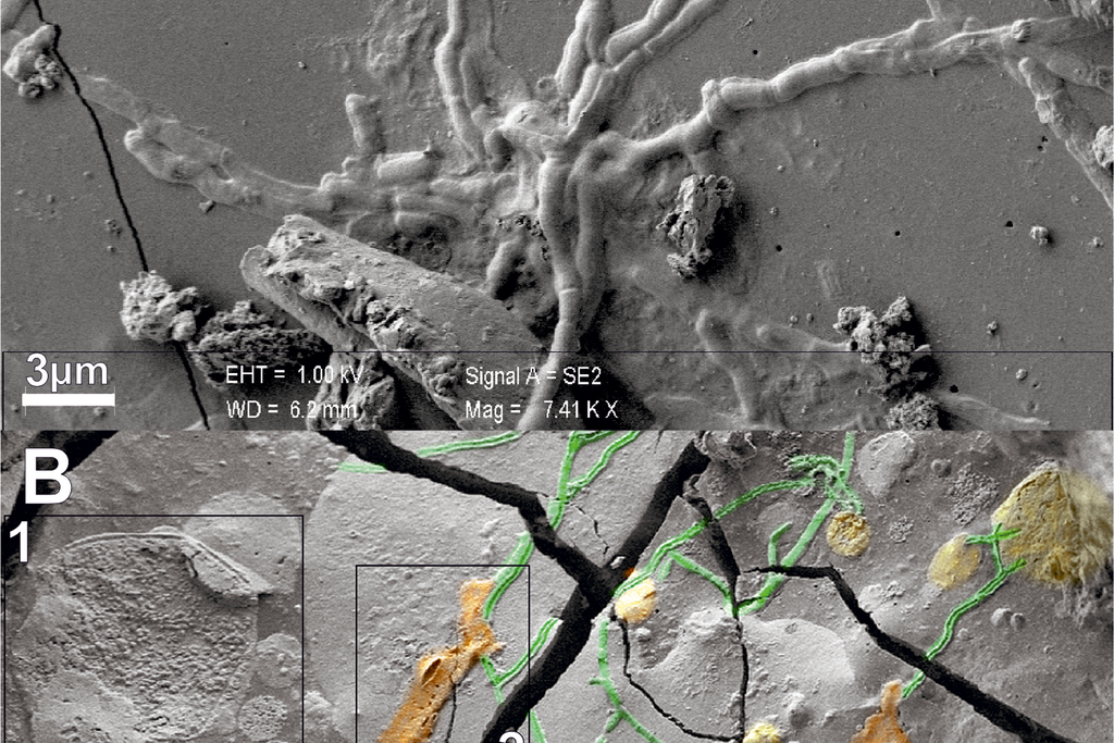 Two images of grey backgrounds with webs of small lines that look like vessels or roots of a plant; these are brain cells, which are thing elongated cells