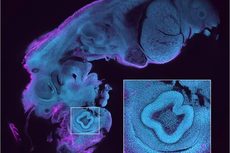 The image shows a 6 mm long, 12.5 day old mouse embryo obtained with the Mesolens. The inset shows a blow-up of the eye region revealing the individual cell nuclei. It is possible to identify fine structures throughout the embryo such as the developing heart muscle fibers and fine details in the eye such as the corneal endothelium using the Mesolens. 